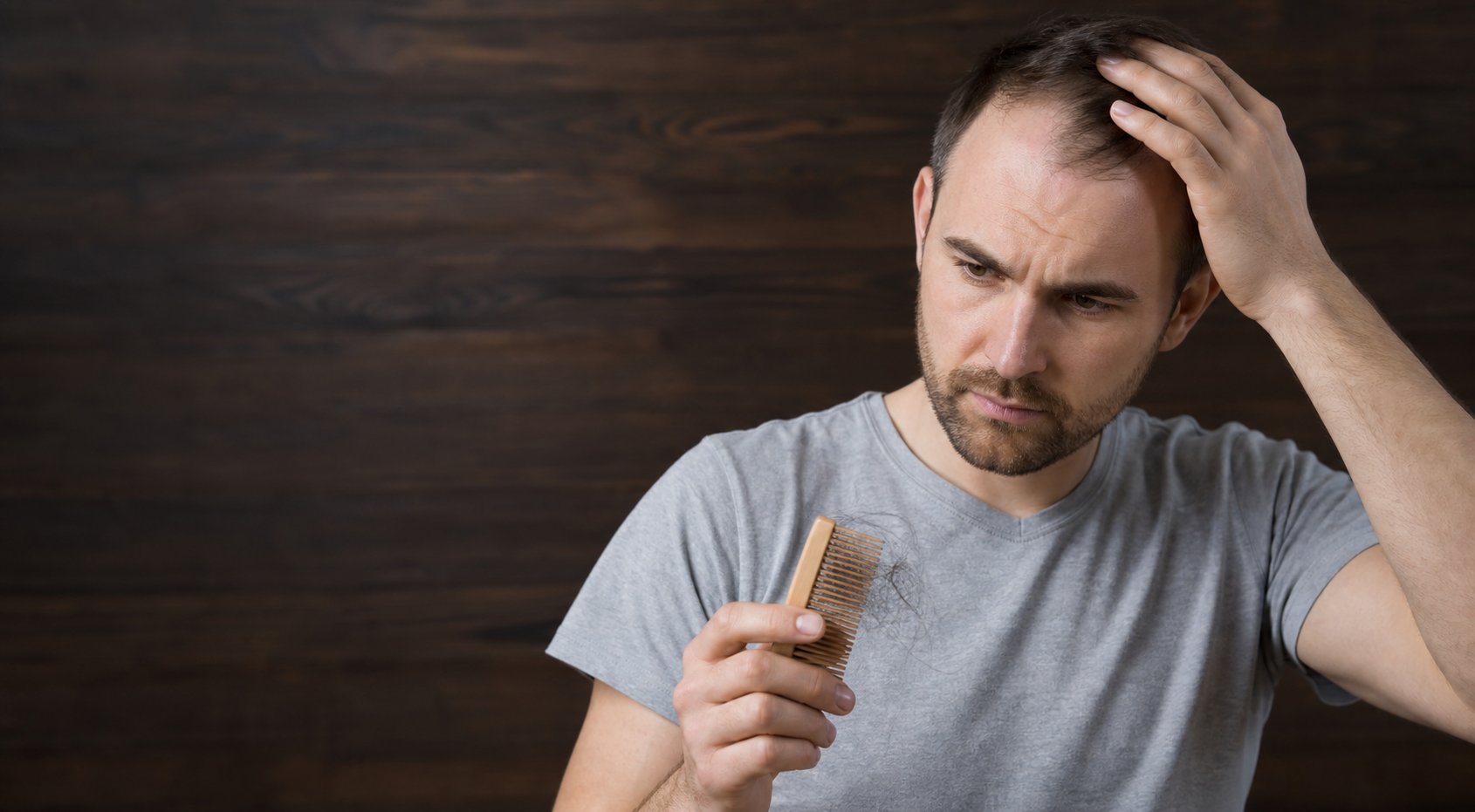 Chute cheveux homme signes inquiétude alopécie